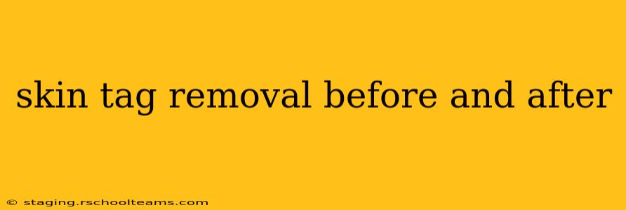 skin tag removal before and after