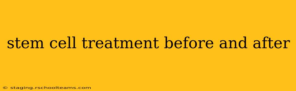 stem cell treatment before and after
