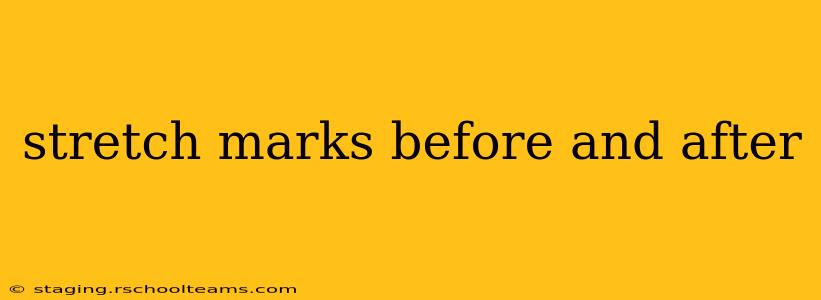 stretch marks before and after
