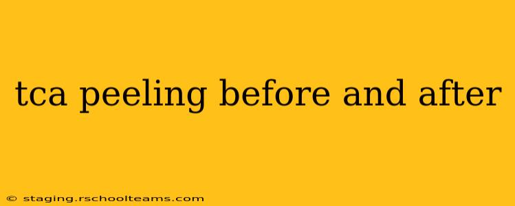 tca peeling before and after