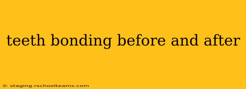 teeth bonding before and after