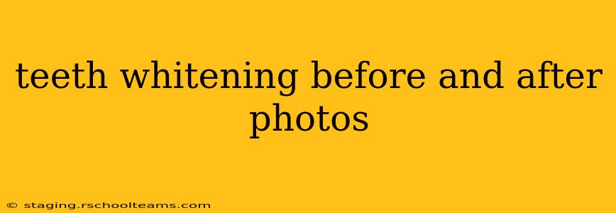 teeth whitening before and after photos