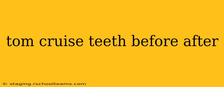 tom cruise teeth before after