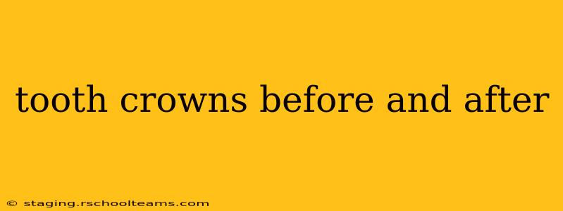 tooth crowns before and after