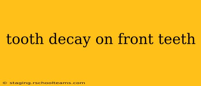 tooth decay on front teeth