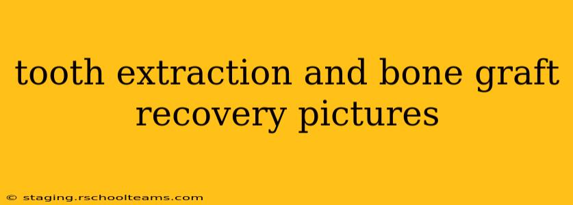 tooth extraction and bone graft recovery pictures