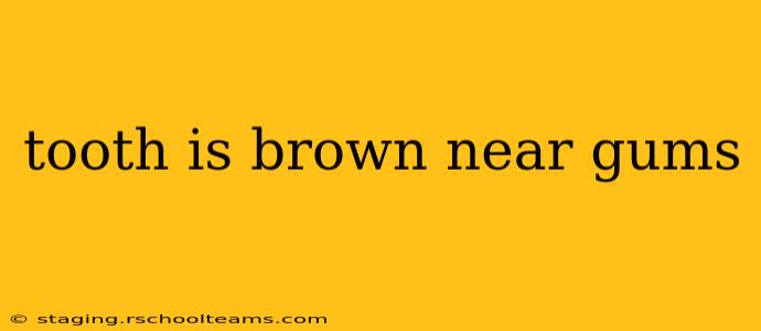 tooth is brown near gums