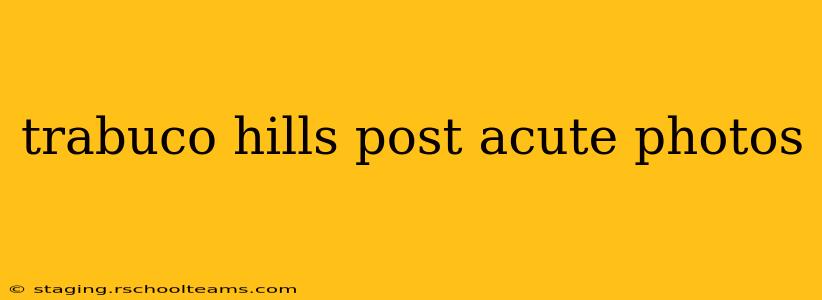 trabuco hills post acute photos