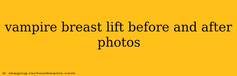 vampire breast lift before and after photos