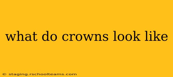 what do crowns look like