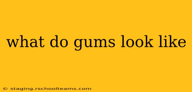 what do gums look like