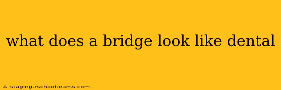 what does a bridge look like dental