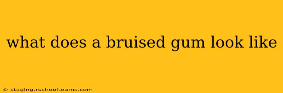 what does a bruised gum look like
