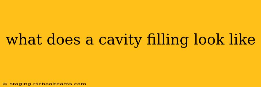 what does a cavity filling look like