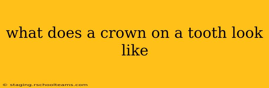 what does a crown on a tooth look like