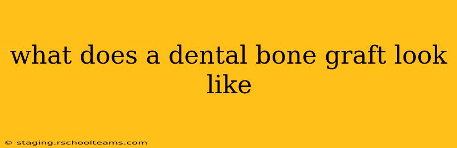 what does a dental bone graft look like