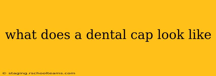 what does a dental cap look like