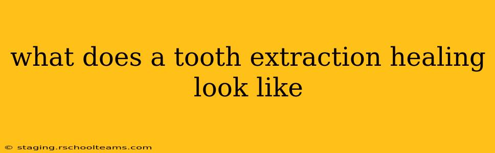 what does a tooth extraction healing look like