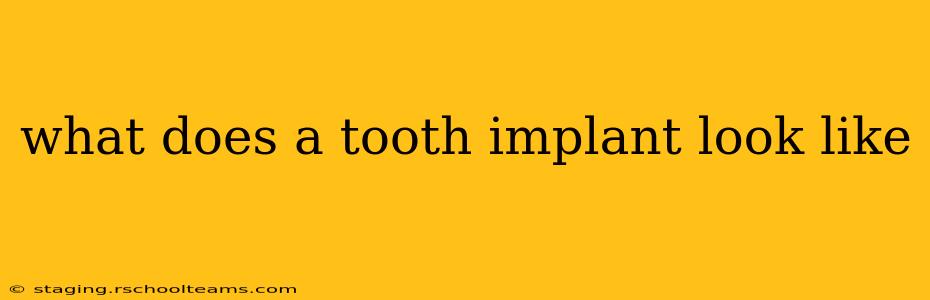 what does a tooth implant look like