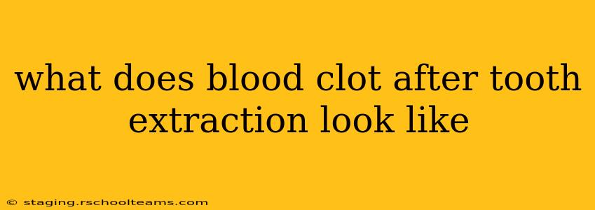 what does blood clot after tooth extraction look like