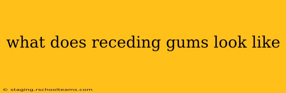 what does receding gums look like