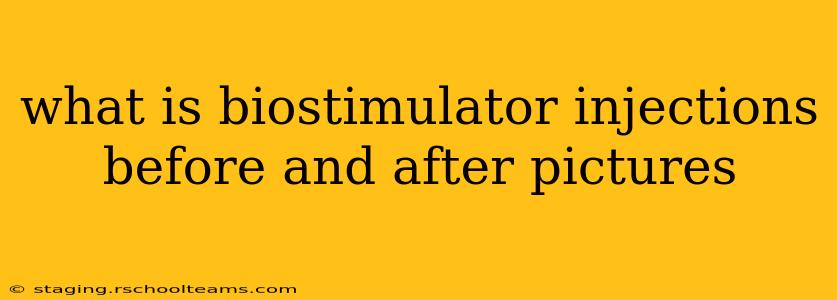 what is biostimulator injections before and after pictures
