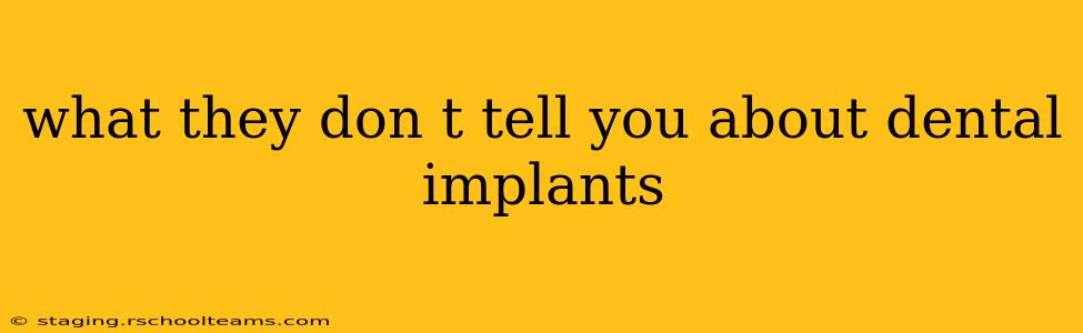 what they don t tell you about dental implants