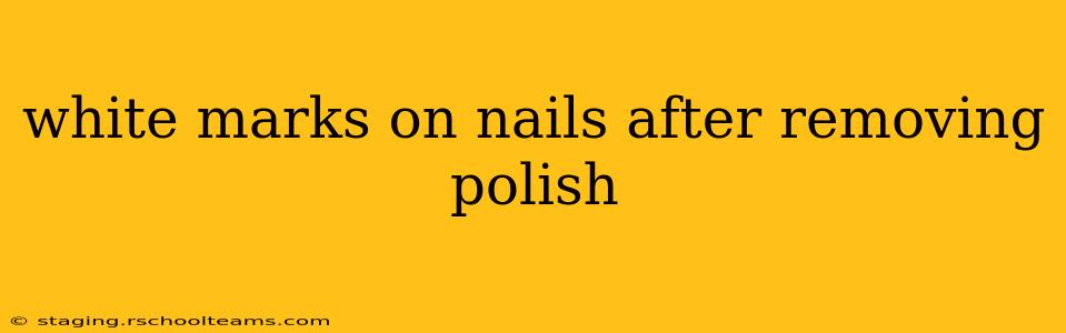 white marks on nails after removing polish