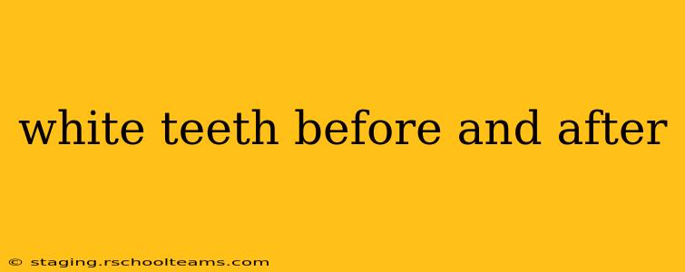 white teeth before and after