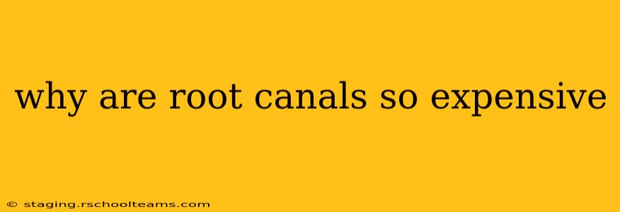 why are root canals so expensive