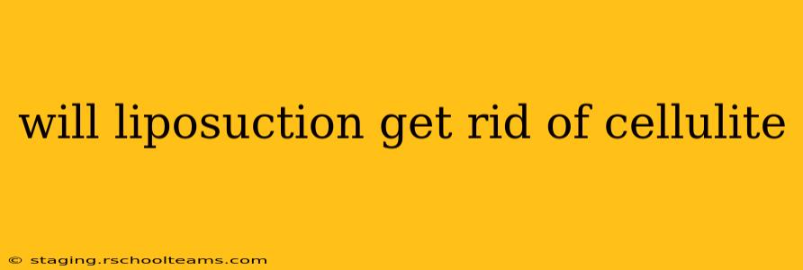 will liposuction get rid of cellulite