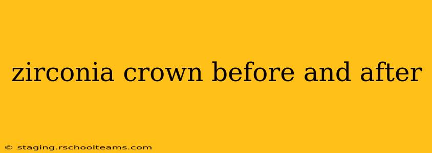 zirconia crown before and after